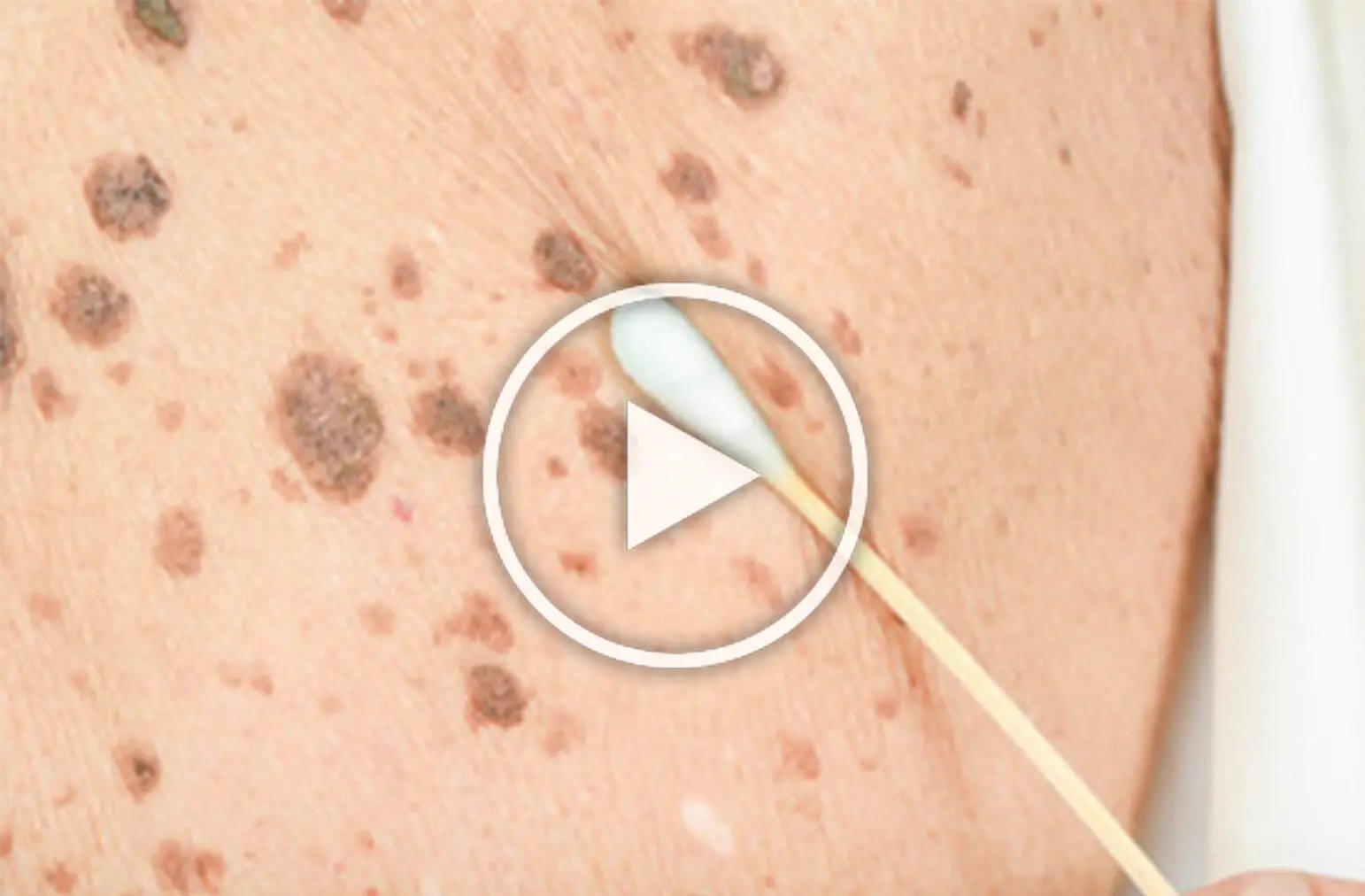 Watch Dr. Gundry's free video tutorial